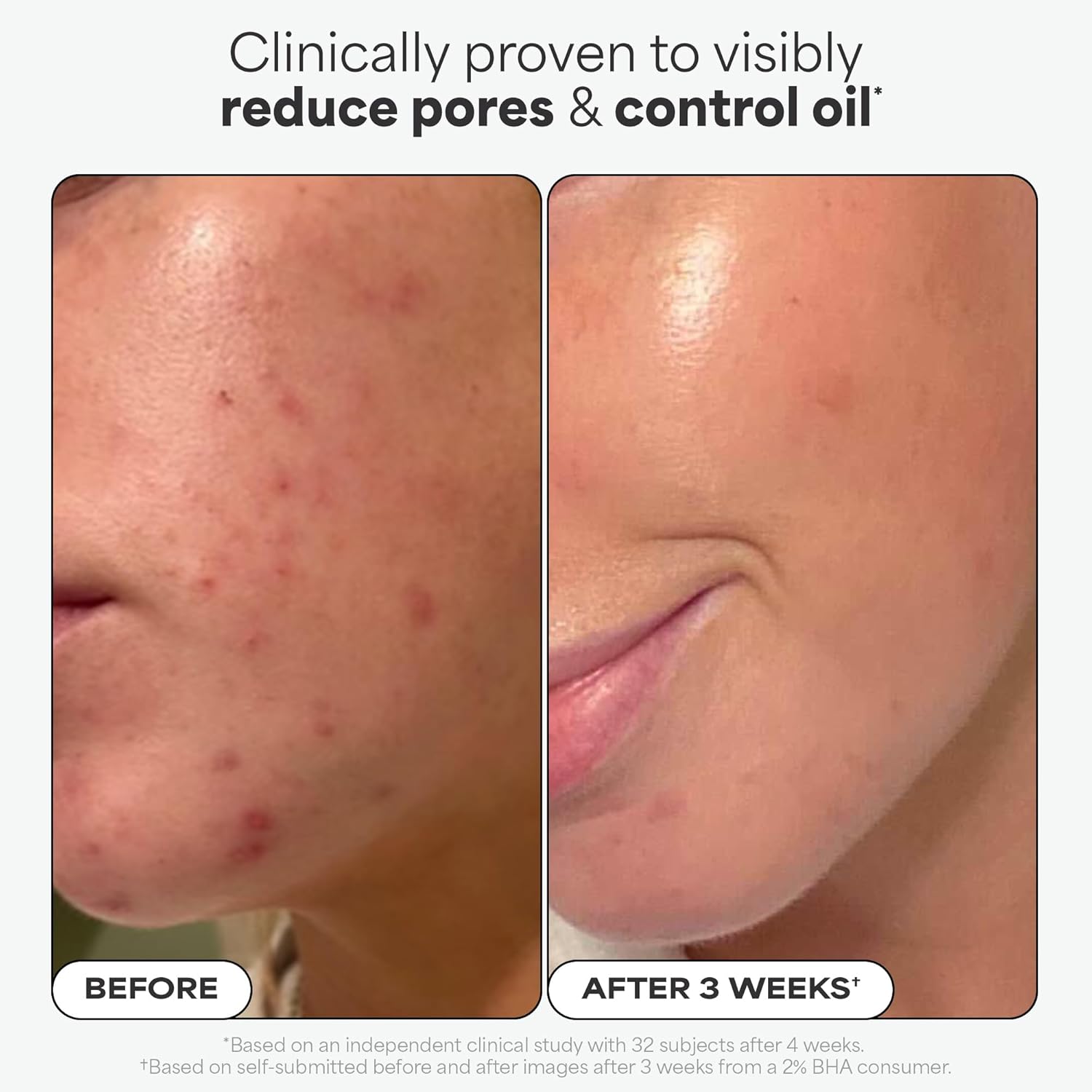 Daily Clear BHA Exfoliant