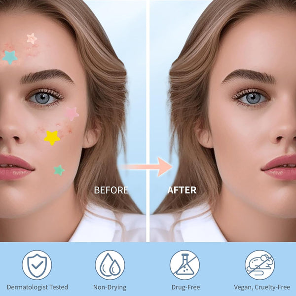 ClearGlow Acne Spot Patches