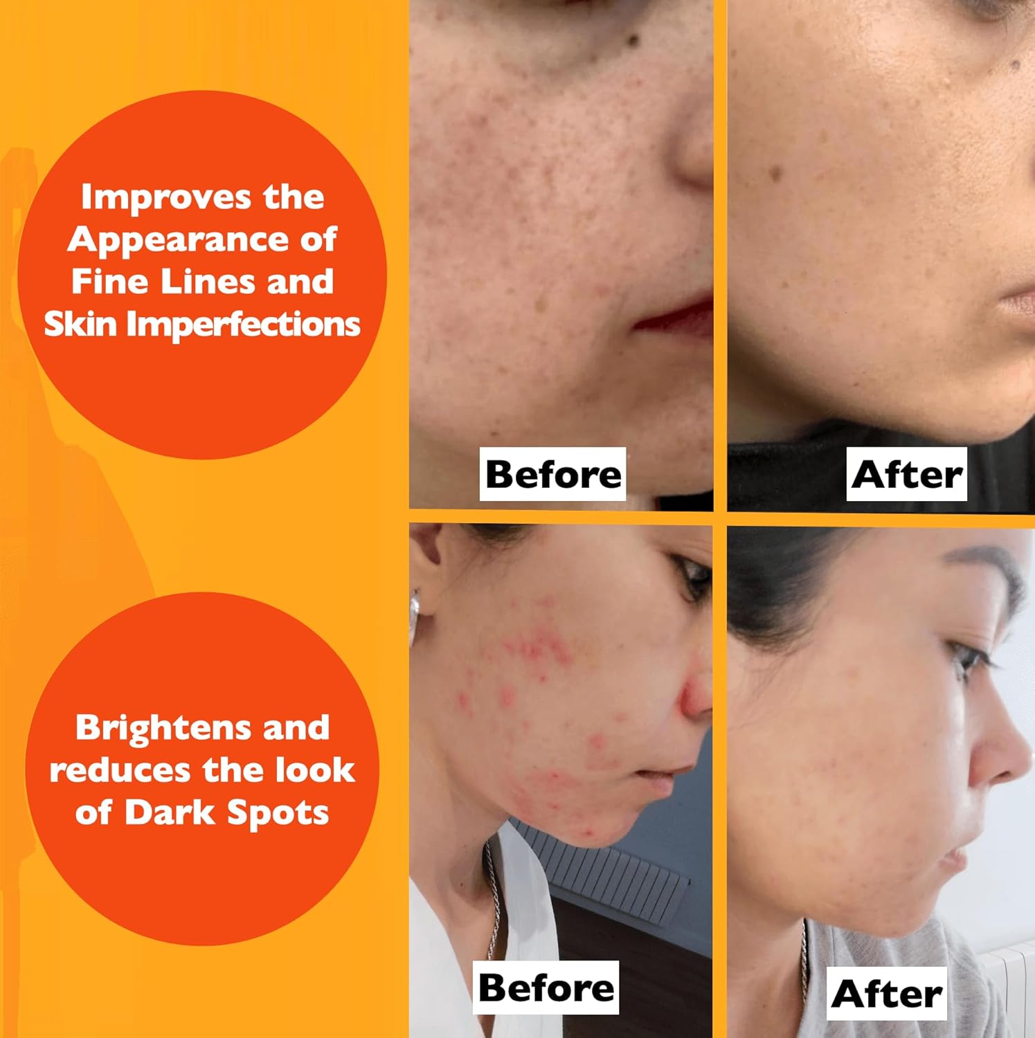 Radiant C Face Serum